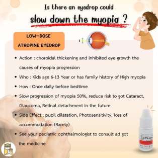 Can an Eye Drop slow down the nearsighted?